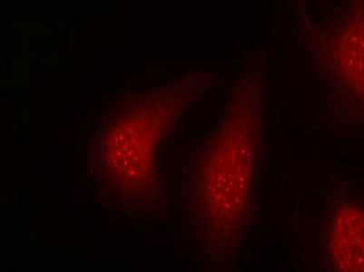 Immunofluorescence staining of methanol-fixed Hela cells using p90RSK(Phospho-Thr348) Antibody.