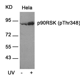 Western blot analysis of extracts from Hela cells untreated or treated with UV using p90RSK(Phospho-Thr348) Antibody. Western blot analysis of extracts from Hela cells untreated or treated with UV using p90RSK(Phospho-Thr348) Antibody.