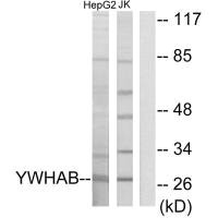 Western blot analysis of extracts from HepG2 cells and Jurkat cells, using 14-3-3 beta antibody. Western blot analysis of extracts from HepG2 cells and Jurkat cells, using 14-3-3 beta antibody.