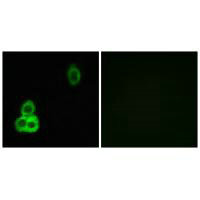 Immunofluorescence analysis of MCF-7 cells, using CELSR1 antibody. Immunofluorescence analysis of MCF-7 cells, using CELSR1 antibody.