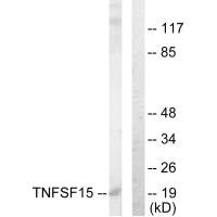 Western blot analysis of extracts from COLO205 cells, using TNFSF15 antibody. Western blot analysis of extracts from COLO205 cells, using TNFSF15 antibody.