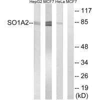 Western blot analysis of extracts from HepG2 cells, MCF-7 cells and HeLa cells, using SLCO1A2 antibody. Western blot analysis of extracts from HepG2 cells, MCF-7 cells and HeLa cells, using SLCO1A2 antibody.
