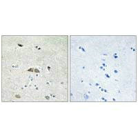 Immunohistochemistry analysis of paraffin-embedded human brain tissue using RL39L antibody. Immunohistochemistry analysis of paraffin-embedded human brain tissue using RL39L antibody.