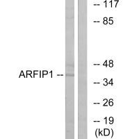 Western blot analysis of extracts from Jurkat cells, using ARFIP1 antibody. Western blot analysis of extracts from Jurkat cells, using ARFIP1 antibody.
