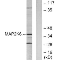 Western blot analysis of extracts from 293 cells, using MAP2K6 antibody.