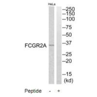 Western blot analysis of extracts from HeLa cells, using FCGR2A antibody. Western blot analysis of extracts from HeLa cells, using FCGR2A antibody.
