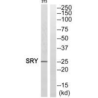 Western blot analysis of extracts from HeLa cells, using SRY antibody. Western blot analysis of extracts from HeLa cells, using SRY antibody.