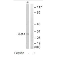 Western blot analysis of extracts from Jurkat cells, using CLM-1 antibody. Western blot analysis of extracts from Jurkat cells, using CLM-1 antibody.