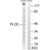 Western blot analysis of extracts from LOVO cells, using AGPAT5 antibody. Western blot analysis of extracts from LOVO cells, using AGPAT5 antibody.