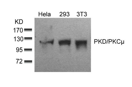 Western blot analysis of extracts from Hela, 293 and 3T3 cells using PKD/PKCm(Ab-910) Antibody. Western blot analysis of extracts from Hela, 293 and 3T3 cells using PKD/PKCm(Ab-910) Antibody.