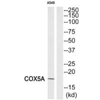 Western blot analysis of extracts from A549 cells, using COX5A antibody. Western blot analysis of extracts from A549 cells, using COX5A antibody.