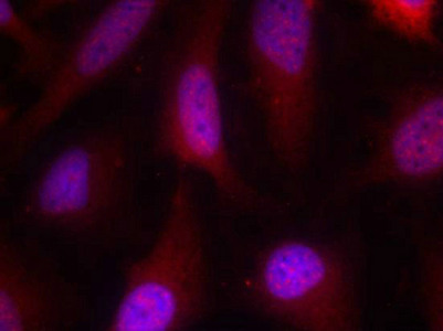 Immunofluorescence staining of methanol-fixed Hela cells using p90RSK(Ab-348) Antibody.