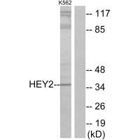 Western blot analysis of extracts from K562 cells, using HEY2 antibody.