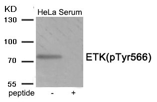 Western blot analysis of extracts from HeLa cells treated with Serum using Phospho-ETK (Tyr566) antibody.The lane on the right is treated with the antigen-specific peptide. Western blot analysis of extracts from HeLa cells treated with Serum using Phospho-ETK (Tyr566) antibody.The lane on the right is treated with the antigen-specific peptide.