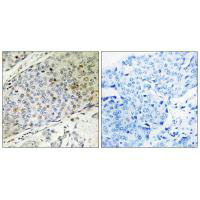 Immunohistochemistry analysis of paraffin-embedded human breast carcinoma tissue, using RMP antibody.