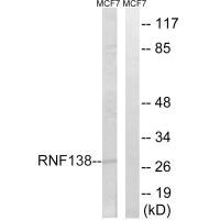 Western blot analysis of extracts from MCF-7 cells, using RNF138 antibody. Western blot analysis of extracts from MCF-7 cells, using RNF138 antibody.