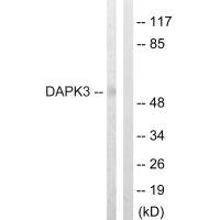 Western blot analysis of extracts from HuvEc cells, using DAPK3 (Ab-265) antibody. Western blot analysis of extracts from HuvEc cells, using DAPK3 (Ab-265) antibody.