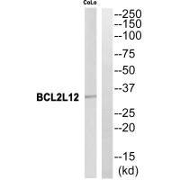 Western blot analysis of extracts from CoLo cells, using BCL2L12 antibody. Western blot analysis of extracts from CoLo cells, using BCL2L12 antibody.