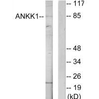 Western blot analysis of extracts from HeLa cells, using ANKK1 antibody. Western blot analysis of extracts from HeLa cells, using ANKK1 antibody.
