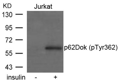 Western blot analysis of extracts from Jurkat cells untreated or treated with insulin using p62Dok(phospho-Tyr362) Antibody. Western blot analysis of extracts from Jurkat cells untreated or treated with insulin using p62Dok(phospho-Tyr362) Antibody.