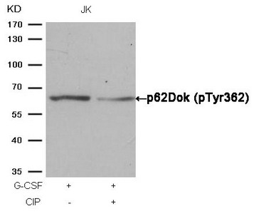 Western blot analysis of extracts from JK cells, treated with G-CSF or calf intestinal phosphatase (CIP), using p62Dok (phospho-Tyr362) Antibody.