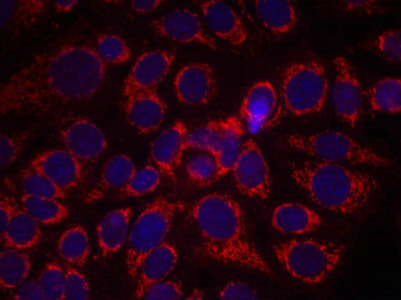 Immunofluorescence staining of methanol-fixed MCF7 cells using HER2(Phospho-Tyr1248) Antibody.