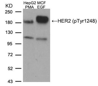 Western blot analysis of extracts from HepG2 cells treated with PMA and MCF cells treated with EGF, using HER2 (Phospho-Tyr1248) Antibody. Western blot analysis of extracts from HepG2 cells treated with PMA and MCF cells treated with EGF, using HER2 (Phospho-Tyr1248) Antibody.