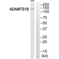 Western blot analysis of extracts from 3T3 cells, using ADAMTS18 antibody. Western blot analysis of extracts from 3T3 cells, using ADAMTS18 antibody.