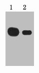 1microg Myc fusion protein + Primary antibody dilution at 1) 1:5000 2) 1:10000