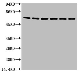 Western blot analysis of A549 (1), Rat brain (2), Mouse brain (3), Chicken lung (4) and Rabbit testis (5), Sheep muscle (6), diluted at 1:5000.