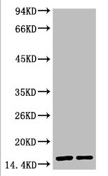 Western blot analysis of Hela, diluted at 1) 1:2000 2) 1:5000 Western blot analysis of Hela, diluted at 1) 1:2000 2) 1:5000
