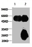 1) Input: Mouse Brain Tissue Lysate 2) IP product: IP dilute 1:200 1) Input: Mouse Brain Tissue Lysate 2) IP product: IP dilute 1:200
