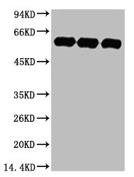 Western blot analysis of 1) Hela, 2) Rat BrianTissue, 3) Mouse Brain Tissue, diluted at 1:5000.