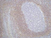 IHC staining of Human tonsil tissue paraffin-embedded, diluted at 1:200.