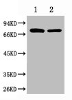 Western blot analysis of 1) Hela, 2) Mouse Brain, diluted at 1:2000.
