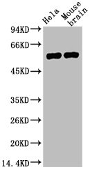 Western blot analysis of 1) Hela, 2) Mouse Brain, diluted at 1:4000.