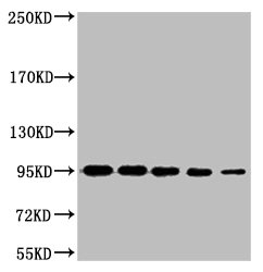 Western blot analysis of 1) Hela, 2) 293T, 3) MCF7, 4) Mouse Brain tissue, 3) Rat LiverTissue, diluted at 1:2000.