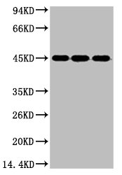 Western blot analysis of 1) Hela, 2) Jurkat, 3) 293T cell lysates, diluted at 1:3000.