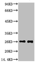 Western blot analysis of 1) Mouse spleen tissue, 2) Rat spleen tissue, diluted at 1:3000.