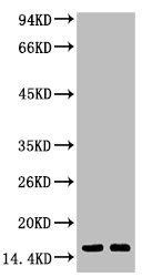 Western blot analysis of Hela, diluted at 1:1000.
