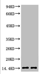 Western blot analysis of Hela, diluted at 1) 1:2000 2) 1:5000