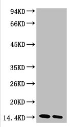 Western blot analysis of Hela, diluted at 1) 1:1000 2) 1:3000