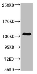 Western blot analysis of Hela, diluted at 1:1000.