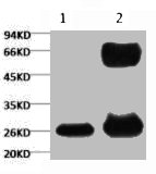 1) Input (control) 2) IP products, antibody dilution 1:200 1) Input (control) 2) IP products, antibody dilution 1:200
