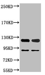 Western blot analysis of 1) Jurkat, 2) Hela, diluted at 1:2000.