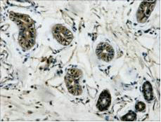 IHC Staining of Human colon tissue, diluted at 1:200.