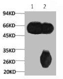 1) Input: Mouse Brain Tissue Lysate 2) IP product: IP dilute 1: 200
