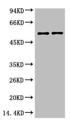 Western Blotting(WB) 2- VIM Monoclonal Antibody