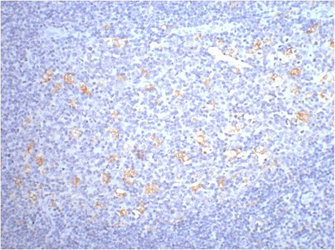IHC staining of human tonsil tissue, diluted at 1:200. IHC staining of human tonsil tissue, diluted at 1:200.