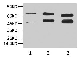 Western blot analysis of 1) Hela, 2)Rat Brain Tissue, 3) Mouse Brain Tissue with Phosphoserine Mouse mAb diluted at 1:2000. Western blot analysis of 1) Hela, 2)Rat Brain Tissue, 3) Mouse Brain Tissue with Phosphoserine Mouse mAb diluted at 1:2000.